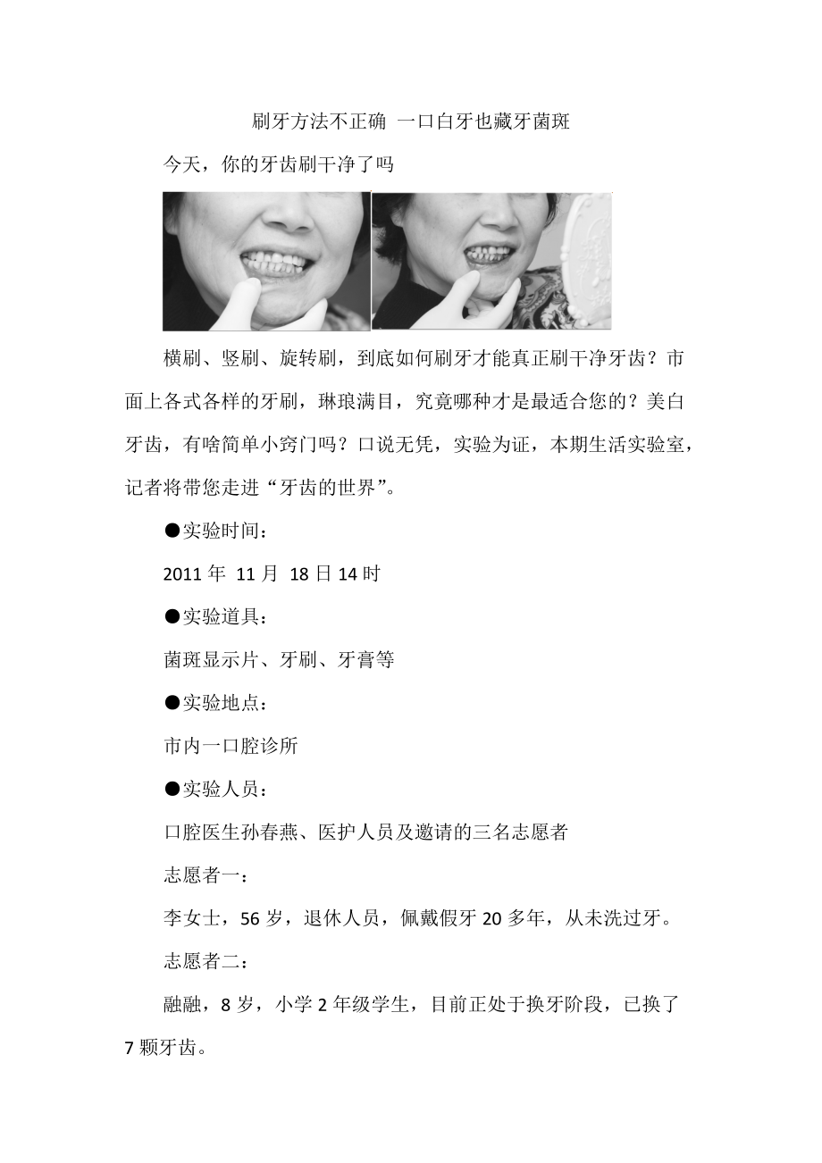 刷牙方法不正确一口白牙也藏牙菌斑_第1页