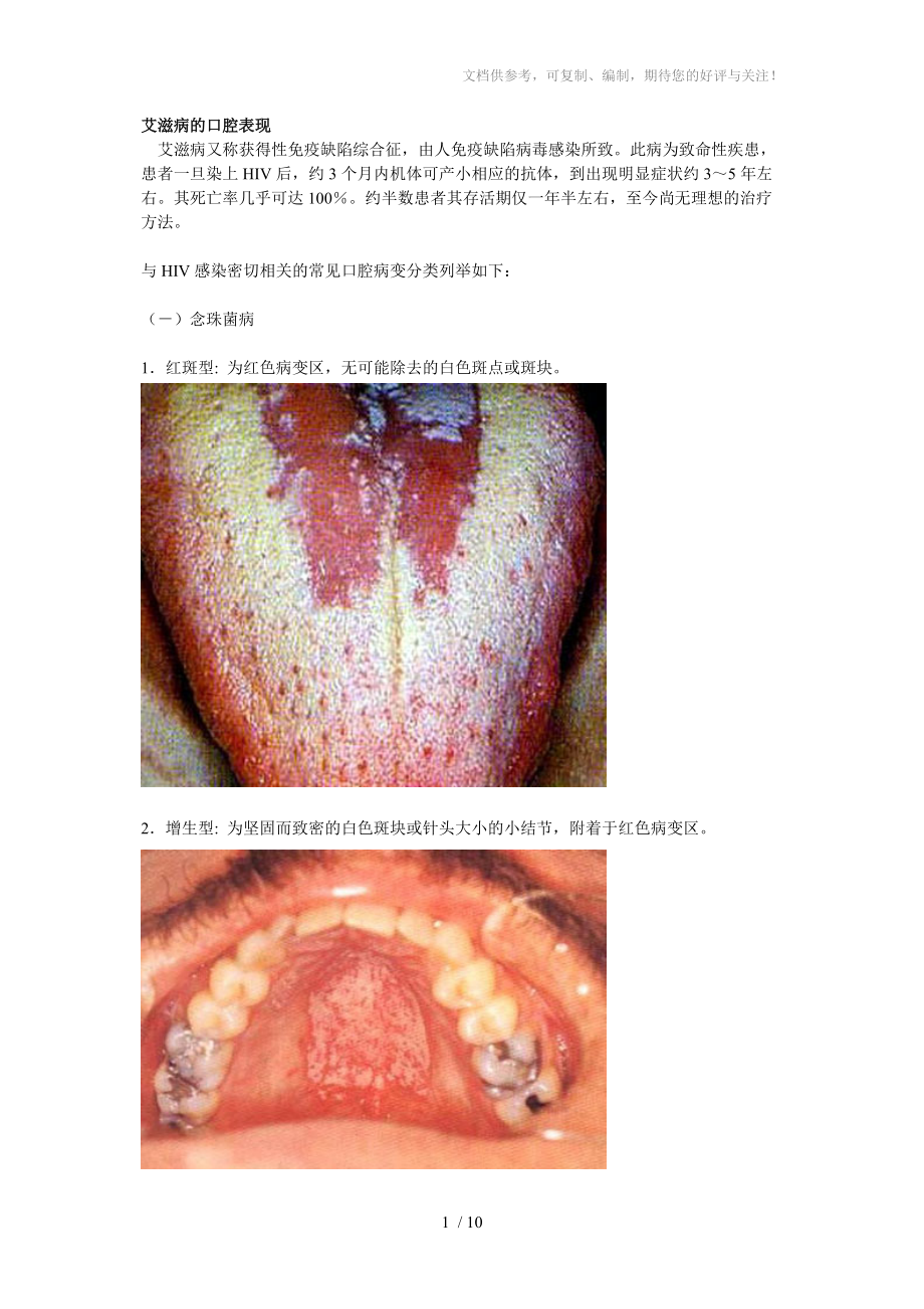艾滋病的口腔表现图谱_第1页